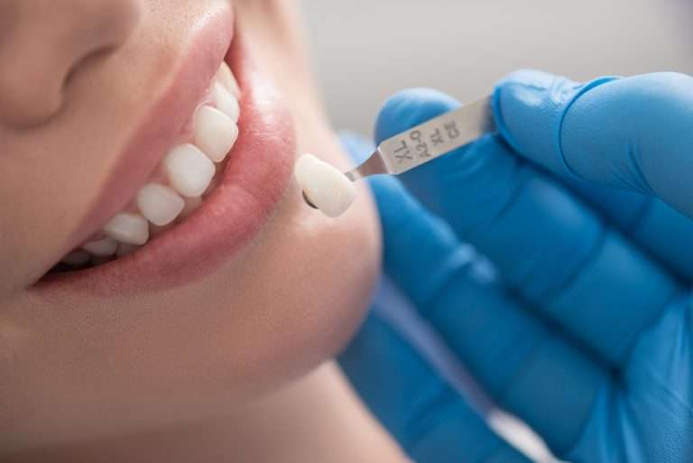 Dental crowns at Premier Family Dental Care in Gilbert, AZ