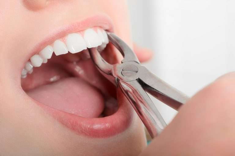 Extract your tooth or save it at Premier Family Dental Care