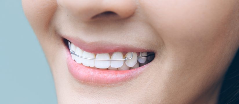 How Straight Teeth Do More than Improve Your Smile - Premier Dental