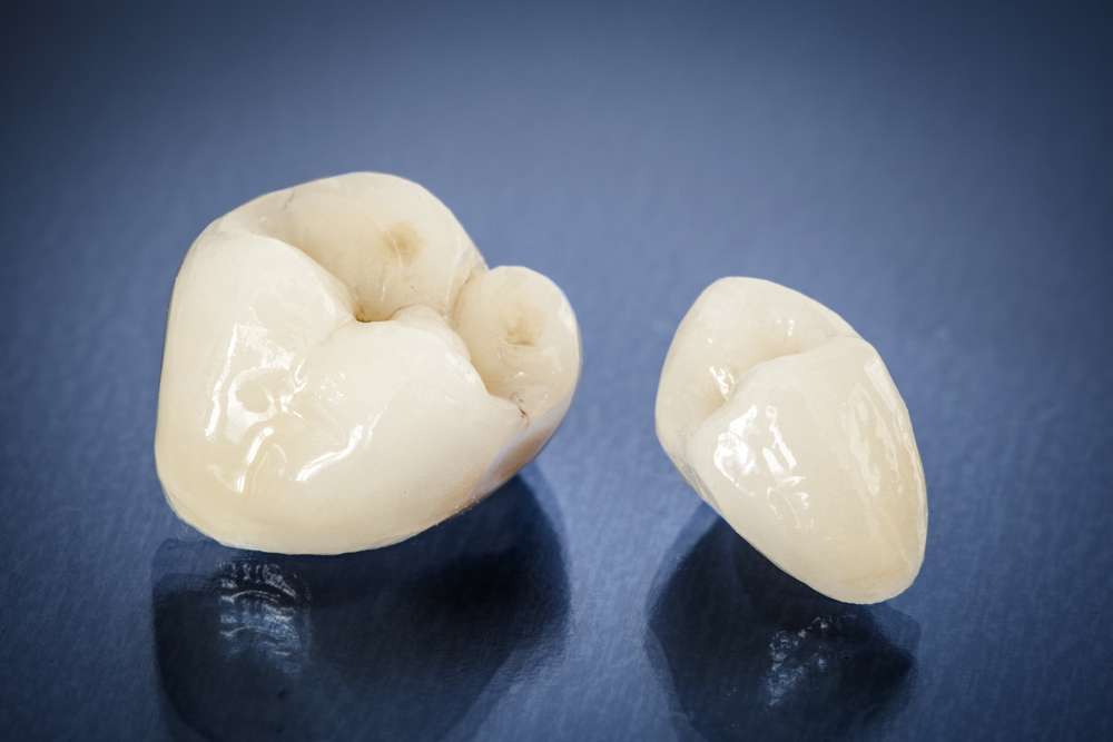 Dental crowns at Premier Family Dental Care in Gilbert, AZ